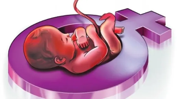 Pre-natal sex determination