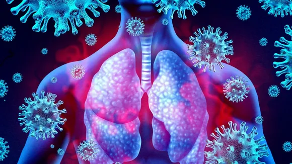 Study finds high rate of lung damage in Indians after acute Covid, experts decode why