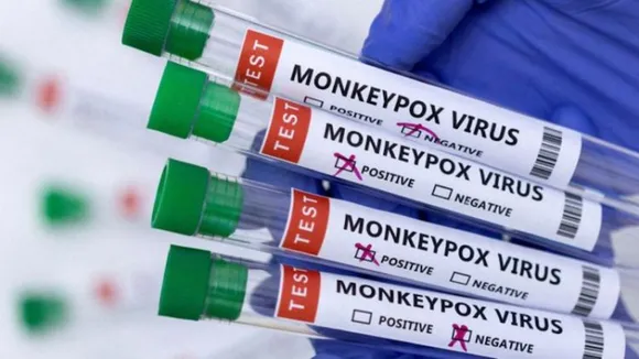 Explainer â Here's what we know about monkeypox, so far
