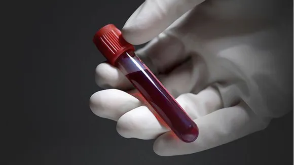 Which Blood Test is Done to Detect Iron Deficiency