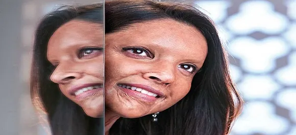 Chhapaak!! Deepika Padukoneâ€™s FIRST LOOK as acid attack survivor REVEALED