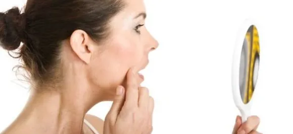 How to remove unwanted facial hair? Follow these 5 simple home remedies