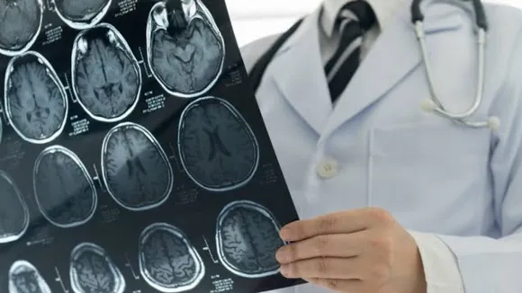 New Algorithm Helps Find Treatment For Brain Cancer In Children: Study 