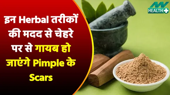 If you are troubled by pimples and its scars then follow this herbal t