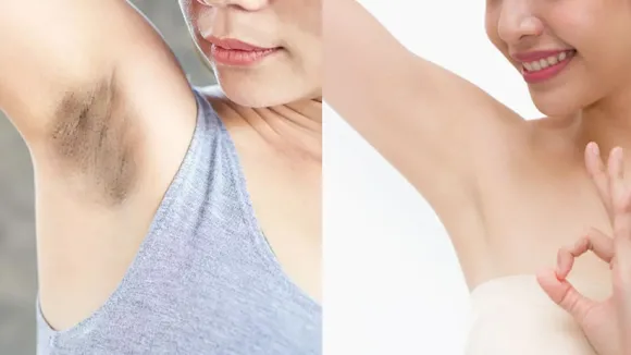 Reduce Dark Underarms