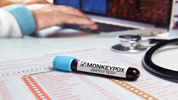 Monkeypox