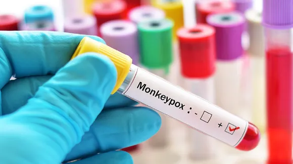 Monkeypox alert 17 Sep