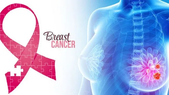 World Cancer Day: ब्रेस्ट कैंसर से हैं ग्रसित तो घबराएं नहीं, अब 65% से भी कम दाम पर उपलब्ध है दवा