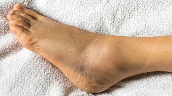 What can cause all over body swelling