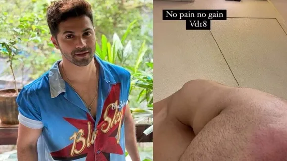 Varun Dhawan gets injured