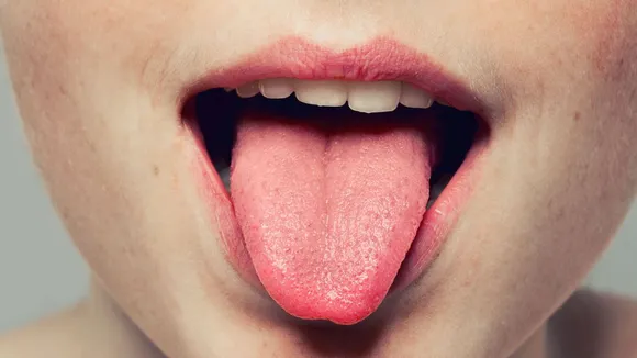 burnt-tongue