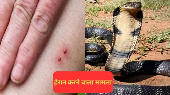 Snake Bite