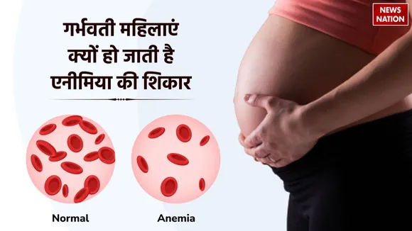 anemia