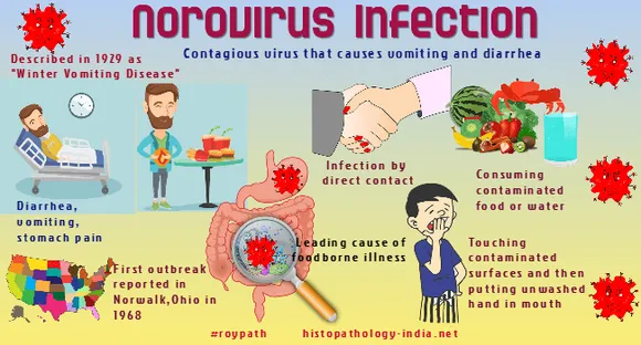 Norovirus
