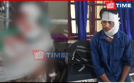 Assam: Father-Son Duo Seriously Injured after Miscreant Attack 