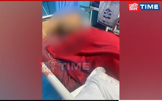 DU Ragging Case: Victim Anand Sharma Undergoes Another Surgery