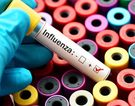 India’s First H3N2 Influenza Death Reported in Karnataka