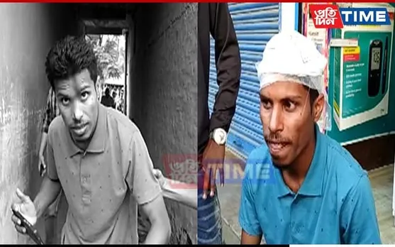 Sivasagar Scribe Injured Amid Protest Outside JJM Contractor's Residence
