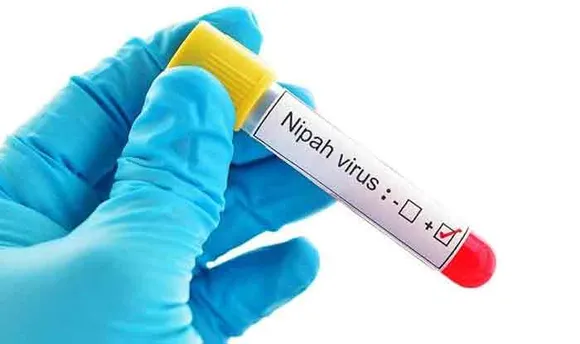 Nipah Virus Claims 2 Lives in Kerala; State Health Dept Steps Up Measures