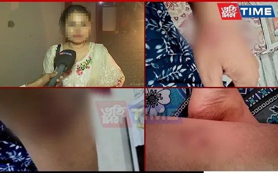 “I Was Brutally Assaulted By My Husband”: Daughter-In-Law of Ex-Assam Minister