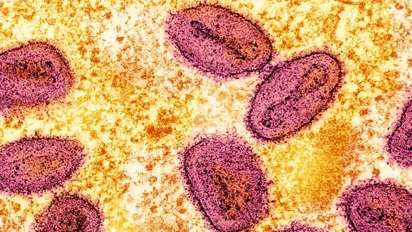 Mpox Scare: Airports, Ports, Borders Put on High Vigil In India