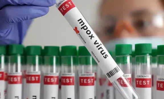 Kerala Confirms 2nd Mpox Case; Health Authorities Tighten Surveillance