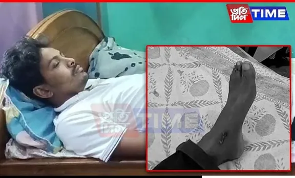 Assam: School Teacher Injured in Attack by Gang of Miscreants