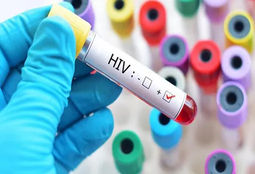 1,65,000 people affected by AIDS in Pakistan: NACP