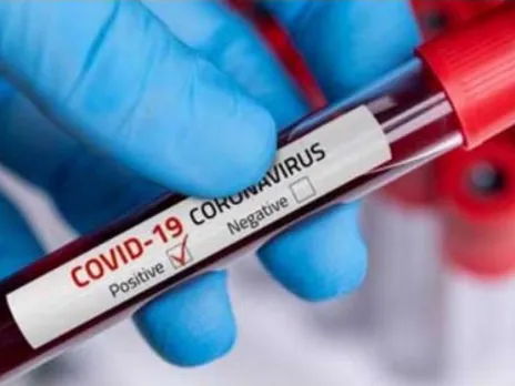 COVID19: Balipara Registers Its Highest Single-Day Cases
