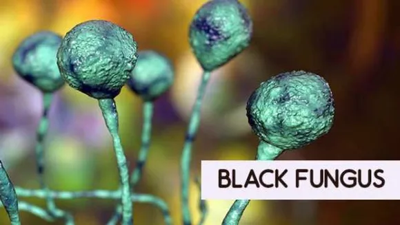 Black Fungus Patient Treated And Discharged: Guwahati