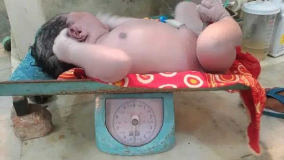 Silchar Woman Delivers Assam’s ‘Heaviest Baby’ Weighing 5.2 Kgs