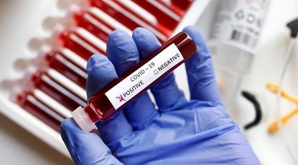 Assam Sees 347 New Covid-19 Cases, Positivity Rate At 0.81%