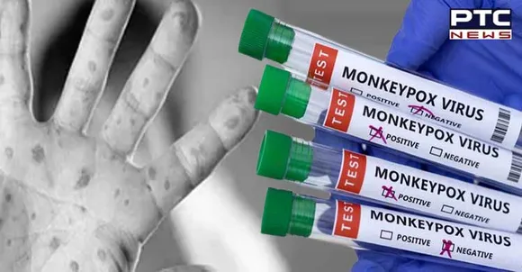 Indonesia reports first case of Monkeypox virus