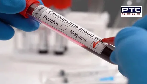 RT-PCR ਟੈਸਟ ਨੈਗੇਟਿਵ ਆਉਣ ਦੇ ਬਾਵਜੂਦ ਵੀ ਤੁਸੀਂ ਕੋਰੋਨਾ ਦਾ ਸ਼ਿਕਾਰ ਹੋ ਸਕਦੇ ਹੋ, ਜਾਣੋ ਕਿਉਂ 