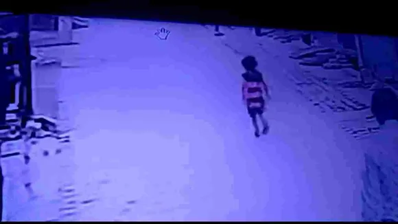 4 साल की बच्ची पर पिटबुल ने किया अटैक, 15 जगह बुरी तरह नोचा, CCTV में कैद तस्वीरें