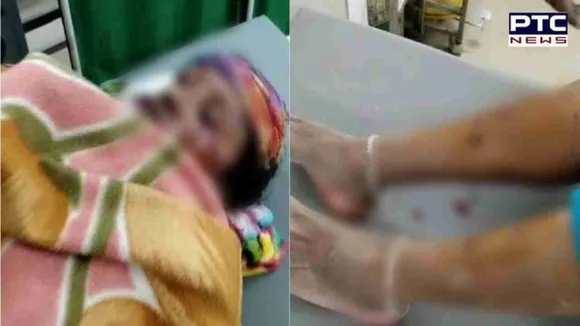 Pitbull Attack on Woman: ਖਰੜ ’ਚ ਪਿਟਬੁੱਲ ਕੁੱਤਿਆਂ ਦੀ ਦਹਿਸ਼ਤ, ਮਹਿਲਾ ਨੂੰ ਬਣਾਇਆ ਸ਼ਿਕਾਰ, ਸਿੱਖ ਵਿਅਕਤੀ ਨੇ ਇੰਝ ਬਚਾਈ ਮਹਿਲਾ ਦੀ ਜਾਨ