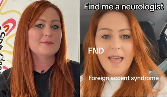 UK Woman Wakes Up Speaking In Different Accent, Seeks Help