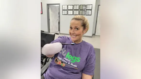 US Woman Who Lost All Limbs Due To Flu Complication Shares Ordeal
