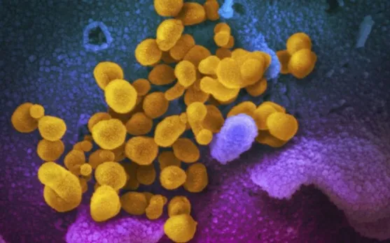 COVID-19 Delta variant, Cytomegalovirus Symptoms ,What Is Cytomegalovirus ,What Is Long COVID, N-0385, Third Wave COVID-19, COVID-19 blood clots