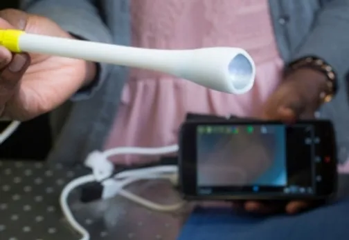 Indian-American Develops Handheld Device For Cervical Cancer Screening