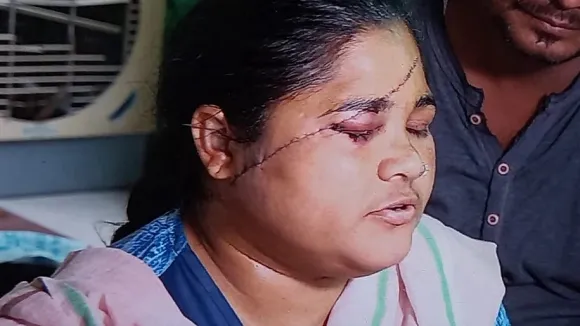 Bhopal Shocker: Woman Gets 118 Stitches On Her Face After Attack By Molesters