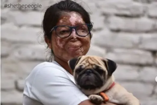 "I Was 15, He Was 55", Acid Attack Survivor Anshu Rajput Shares How She Fought The Odds