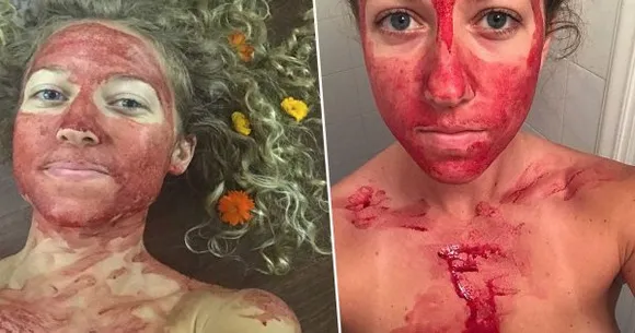 Smearing Menstruation Blood On One’s Face Is Not Empowering