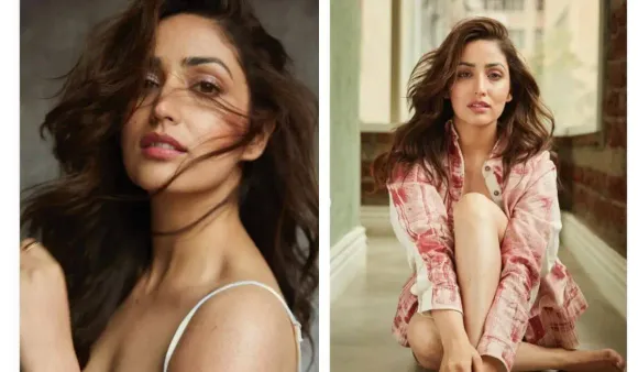 Accepting ‘flaws’ Wholeheartedly: Yami Gautam Shares Unedited Pics, Reveals Skin Condition