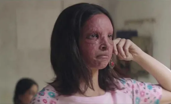 Chhapaak Trailer Promises Inspiring Journey Of An Acid Attack Survivor