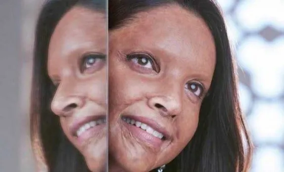 Chhapaak Leaves You Emotional, Thoughtful And More Human