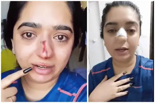 Zomato Delivery Boy Refutes Woman’s Charge, Says She Hit Her Nose With Her Own Ring