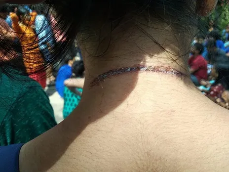 They Can’t Terrorize Us: Satarupa Chakraborty, Attacked JNU Student