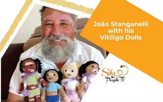 Grandfather Crochets Vitiligo Dolls To Boost Children's Self Esteem