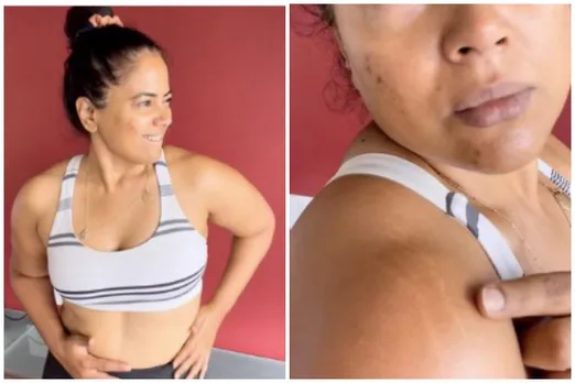 We need to love our bodies, and its stretch marks says actor-influencer Sameera Reddy